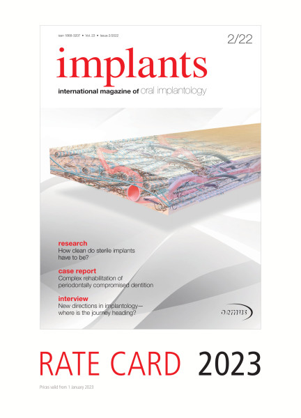 Cover bild gehörig zu Rate card implants